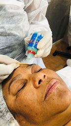 Gel TKTX 15 ml